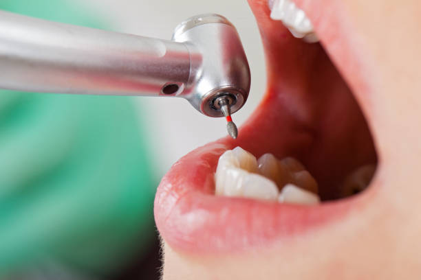 Best Pediatric Emergency Dentist in Eaton, CO